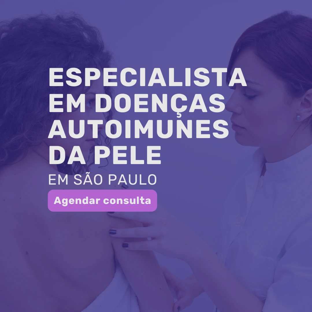 especialista em doenças autoimunes da pele sp